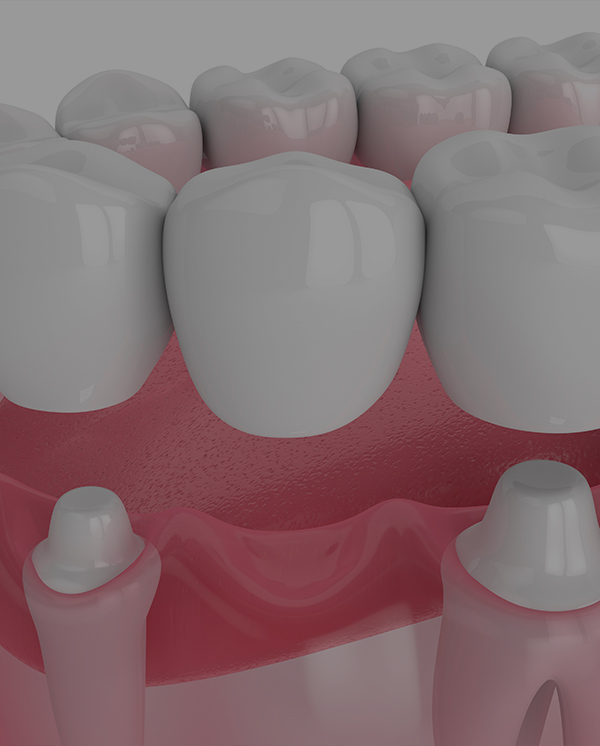 Treatment - Novo Dental Practice