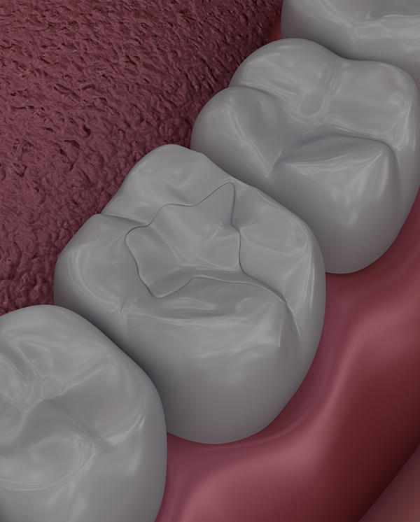 Treatment - Novo Dental Practice