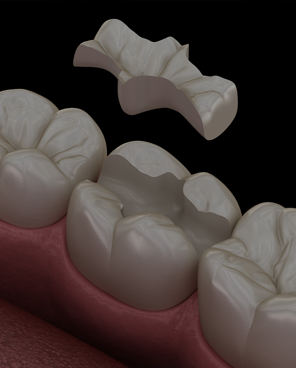 Treatment - Novo Dental Practice