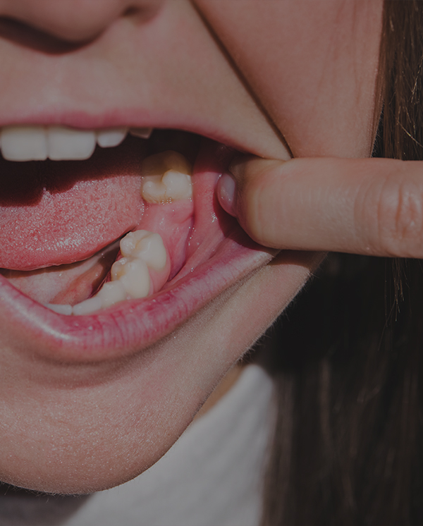 Treatment - Novo Dental Practice