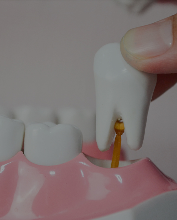 Treatment - Novo Dental Practice