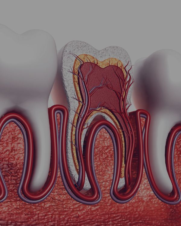 Treatment - Novo Dental Practice
